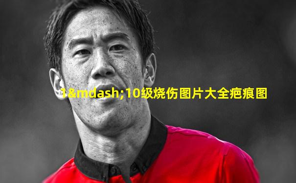 1—10级烧伤图片大全疤痕图